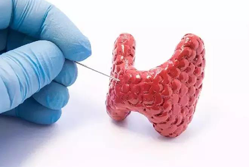 甲状腺疾病，包括甲状腺功能减退和甲状腺功能亢进，自古以来就是反复被医学研究人员研究的疾病